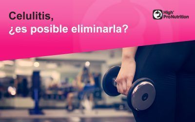 Celulitis, ¿es posible eliminarla?